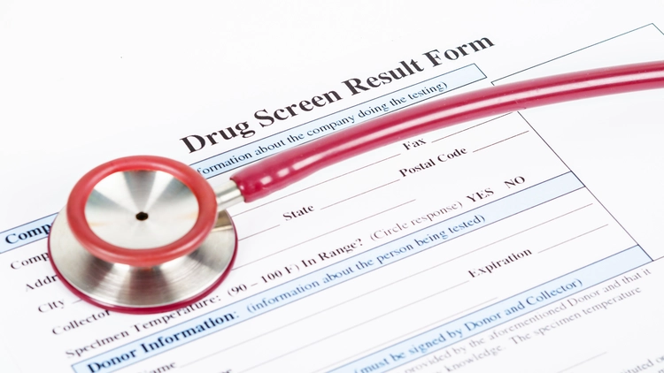 Drug screening result form with a stethoscope on top.