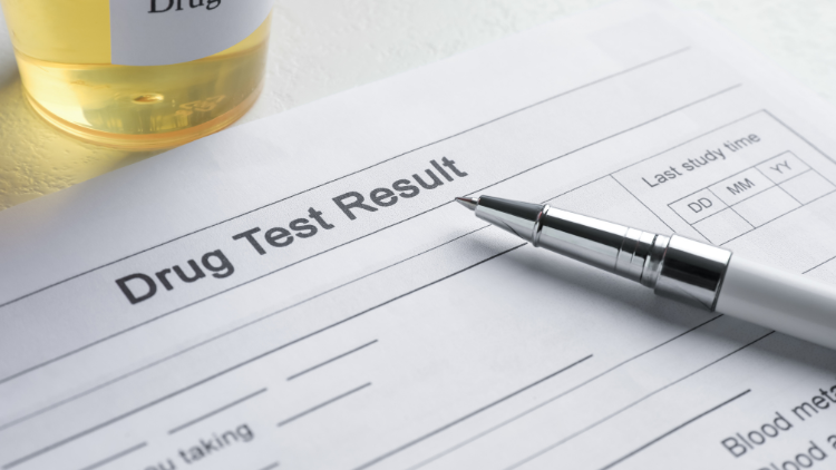 Close-up of drug test result form and sample with pen on top.